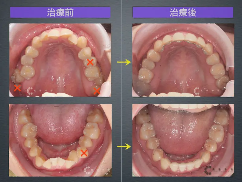 隱適美-許小姐 隱適美-許小姐
